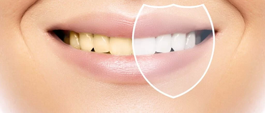 estetik-dis-hekimligi-1-1024x438