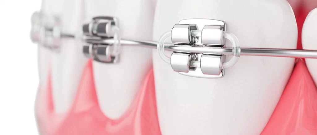 ortodonti-cover-1024x438