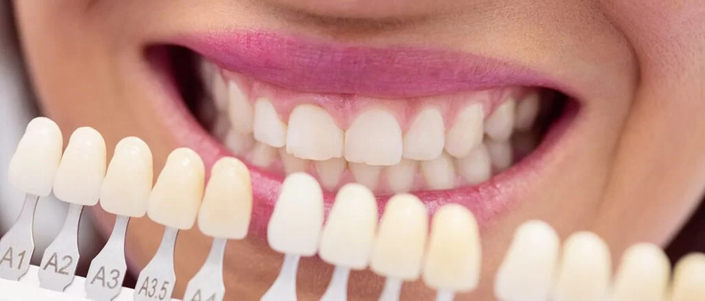 zirkonyum-kaplama-cover-1024x438